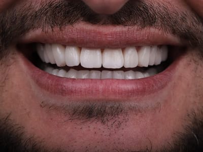 Dental Clinic Village of Dentistry Hallandale Beach