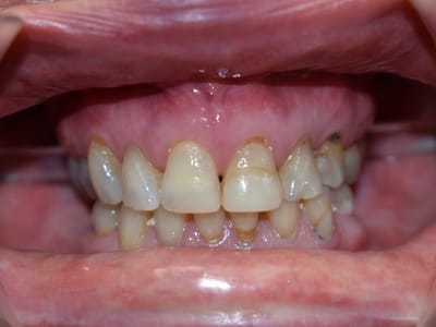 Dental Partners of Creve Coeur