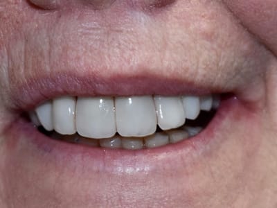 Dental Partners of Creve Coeur