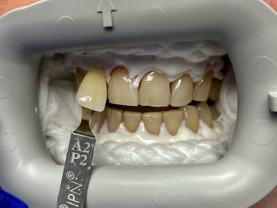 Dental Partners of Creve Coeur