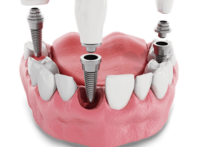 Dentist 101 of Houston