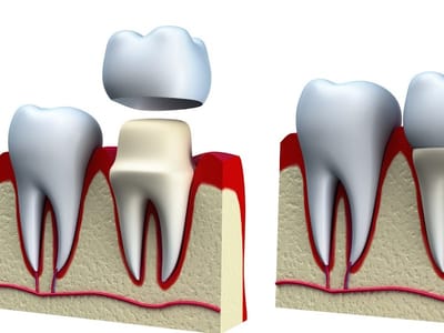 Dentist 101 of Houston