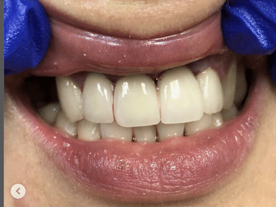 Dentist 11209 Bay Ridge | Stuart Feintuch DDS