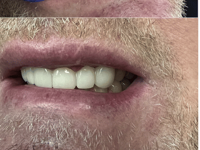 Dentist 11209 Bay Ridge | Stuart Feintuch DDS