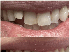 Dentist 11209 Bay Ridge | Stuart Feintuch DDS