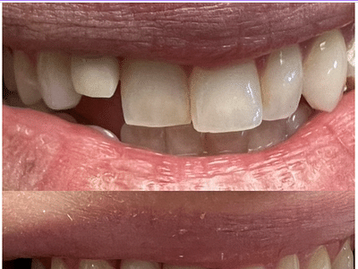 Dentist 11209 Bay Ridge | Stuart Feintuch DDS