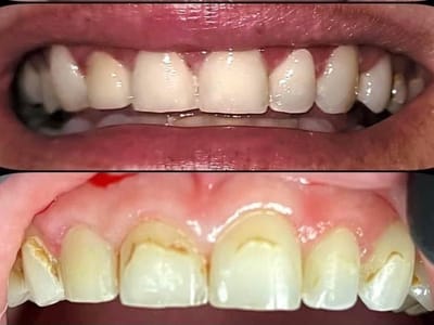 Dentist Jefferson City - Hometown Dental