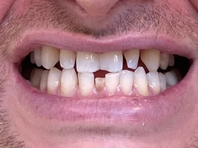 Dentist North Eastham - Dental Arts Studio of Cape Cod