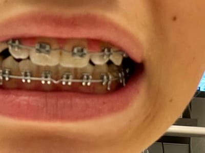 Dentist Queen Creek - Matheson Dentistry & Implant Center