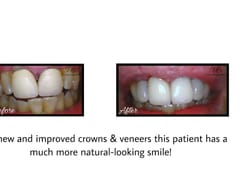 Dentist Redwood City - United Dental