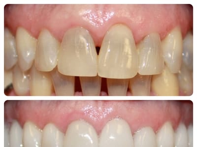 Dentist Springfield - Nathan M Anderson DMD