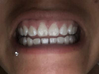 Dentistry For The Entire Family