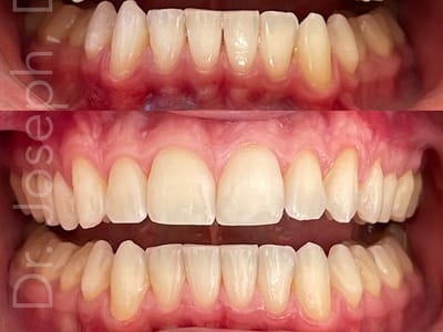 Dentistry of San Francisco, General & Cosmetic Dentist Dr. Joseph DDS