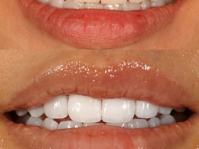 Dentistry of San Francisco, General & Cosmetic Dentist Dr. Joseph DDS