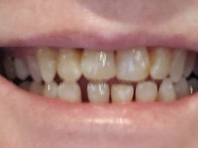 Dentistry of the Carolinas - East Charlotte