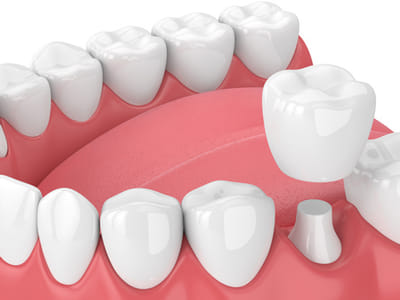 Desert Valley Dental | Sparks