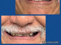 Designer Smiles