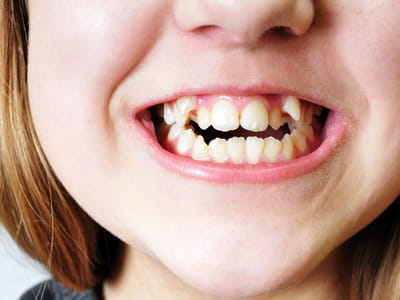 Direct Dental - Dentist in Pico Rivera