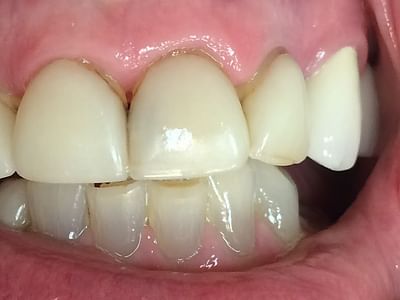 Double Diamond Dental: Michael A Morgan DDS