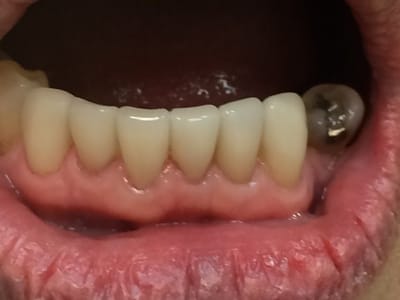 Double Diamond Dental: Michael A Morgan DDS