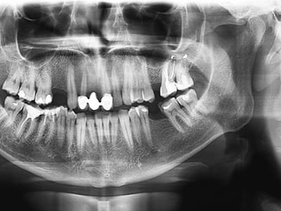 Dove Family Dentistry - Covington Pike