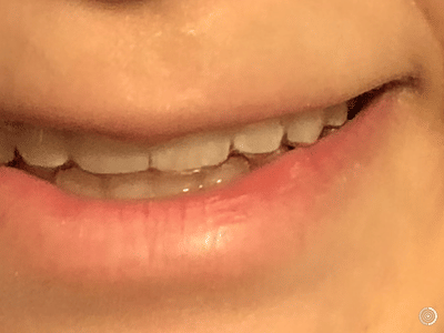 Dr. Dale Belnap, D.D.S.: Colleyville Dentistry