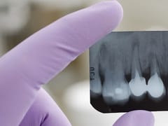 Dr. Don B Ruhnke DDS