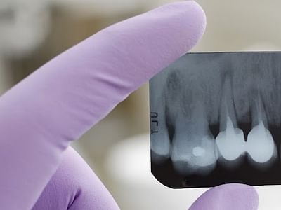 Dr. Don B Ruhnke DDS