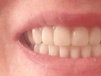 Dr. Francisco Fuentes, DDS