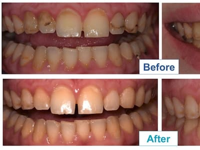 Dr. Jessie Yang, DDS: Cosmetic Dentistry & Clear Aligners