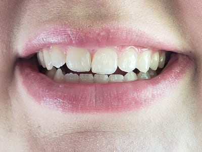 Dr. Kevin Lacour Family Dentistry of Lilburn