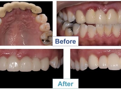 Dr. Merchant, DDS: Emergency Dentistry & Oral Surgery