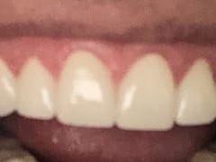 Dr. Robert Muller, DDS