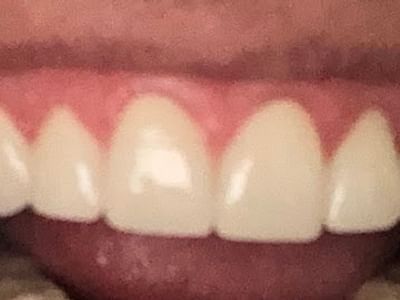 Dr. Robert Muller, DDS