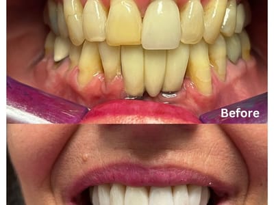 Dr. Sam Lavi Cosmetic and Implant Dentistry