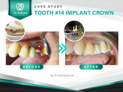 Dr Smilee Dental of Waco Family, Medicaid, Dental Implant, Emergency Dentistry