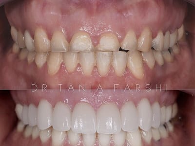 Dr. Tania Farshi DDS - North Hollywood Dentist
