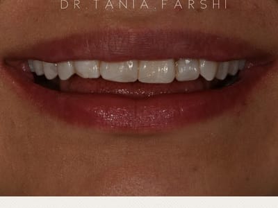 Dr. Tania Farshi DDS - North Hollywood Dentist