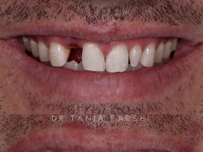 Dr. Tania Farshi DDS - North Hollywood Dentist