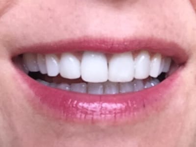 Dr. Thomas R. Dickson, DDS