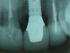 Dr. Thomas Torre DMD {Family, Cosmetic and Implant Dentistry }