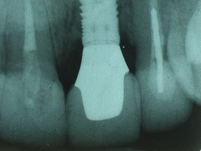 Dr. Thomas Torre DMD {Family, Cosmetic and Implant Dentistry }