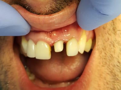 Dr. Thomas Torre DMD {Family, Cosmetic and Implant Dentistry }