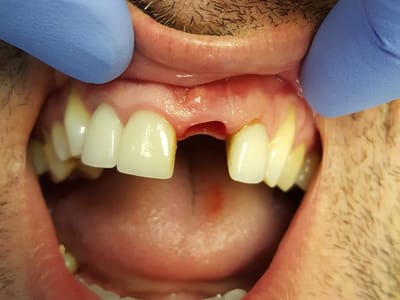 Dr. Thomas Torre DMD {Family, Cosmetic and Implant Dentistry }