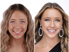 Draper Smiles - Dr. Fernando Pessoa: World-Class Dentistry