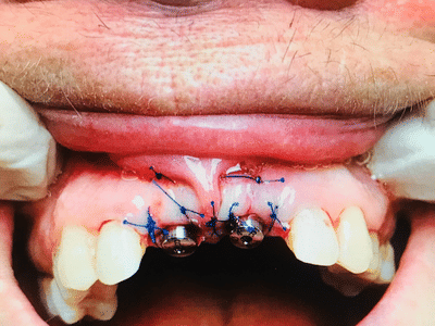 East Wind Dental Care