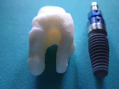 El Dorado Hills Cosmetic, Implant & Family Dentistry