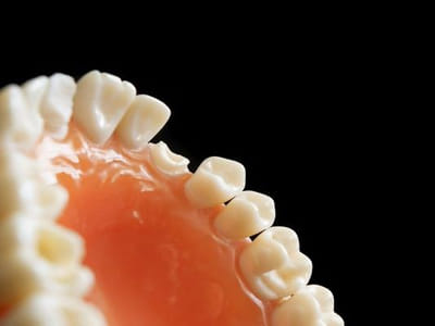 El Dorado Hills Cosmetic, Implant & Family Dentistry