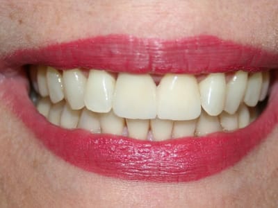 Elizabeth H. Lee, DDS