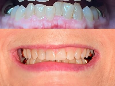 Elwood Avenue Dental